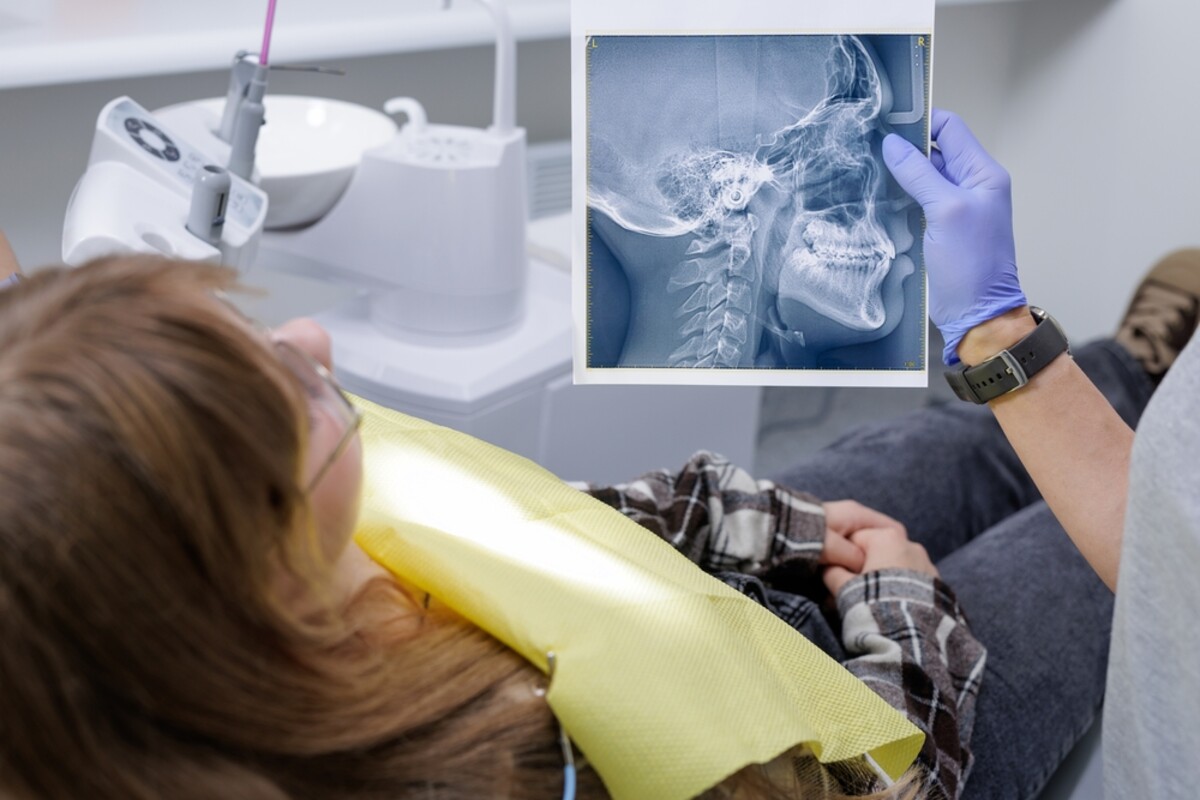 What Are Neuromodulators at the Dentist and How Can They Help with TMJ Pain
